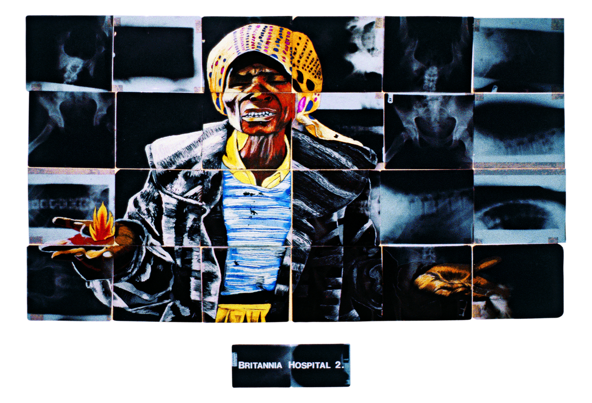 A collage in landscape format comprising an number of X ray images overlaid by a head and shoulders portrait of an anguished figure in a multi-coloured headscarf.